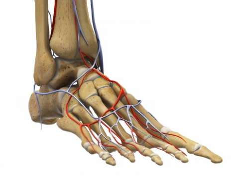 Circulatory disorders are contraindications to bunion surgery