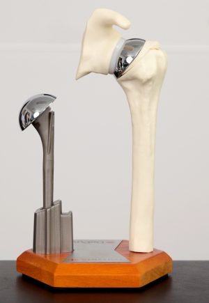 Prosthesis for total shoulder replacement or total shoulder arthroplasty