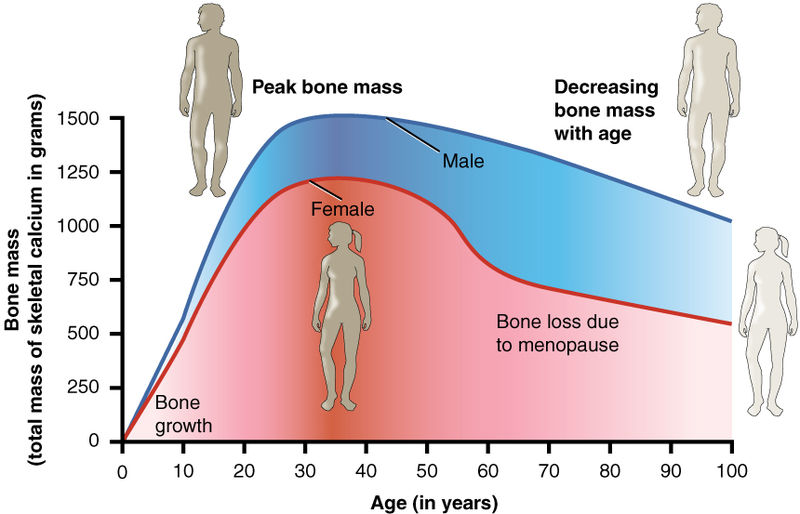 Diagram shows the average development during the lifetime of a human. Loss of bone mineralisation and density often goes unnoticed by the individual. 
