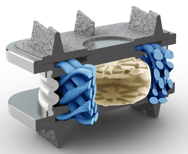 A prosthesis that wants to replace the natural intervertebral disc must replicate all the essential properties of the natural intervertebral disc.