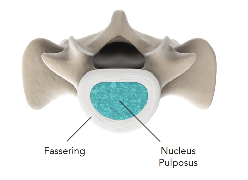 The anatomic structure of the healthy spine. The intervertebral disc is the flexible connection between two vertebral bodies.