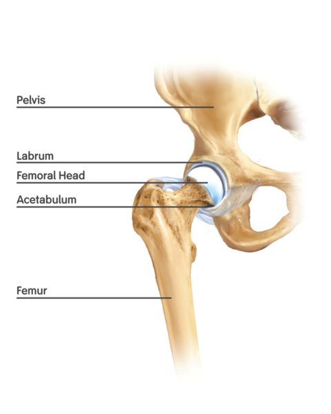 Chronic hip pain can be treated by arthroscopy of the hip