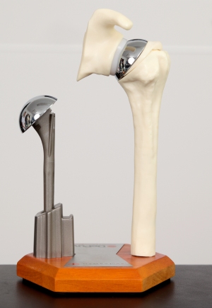 shoulder-arthroplasty.jpg