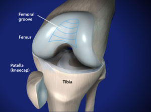 Knee specialists approach to osteoarthritis of the knee