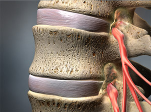 https://www.joint-surgeon.com/orthopedic-joint-surgeon/spine-specialist/nerve-root%20compression-radiculopathy.jpg